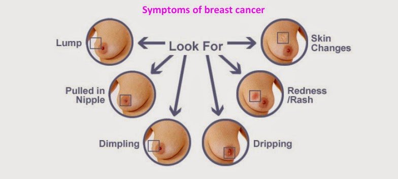 treatment for breast cancer